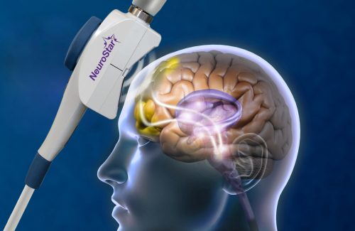 Brain network photo